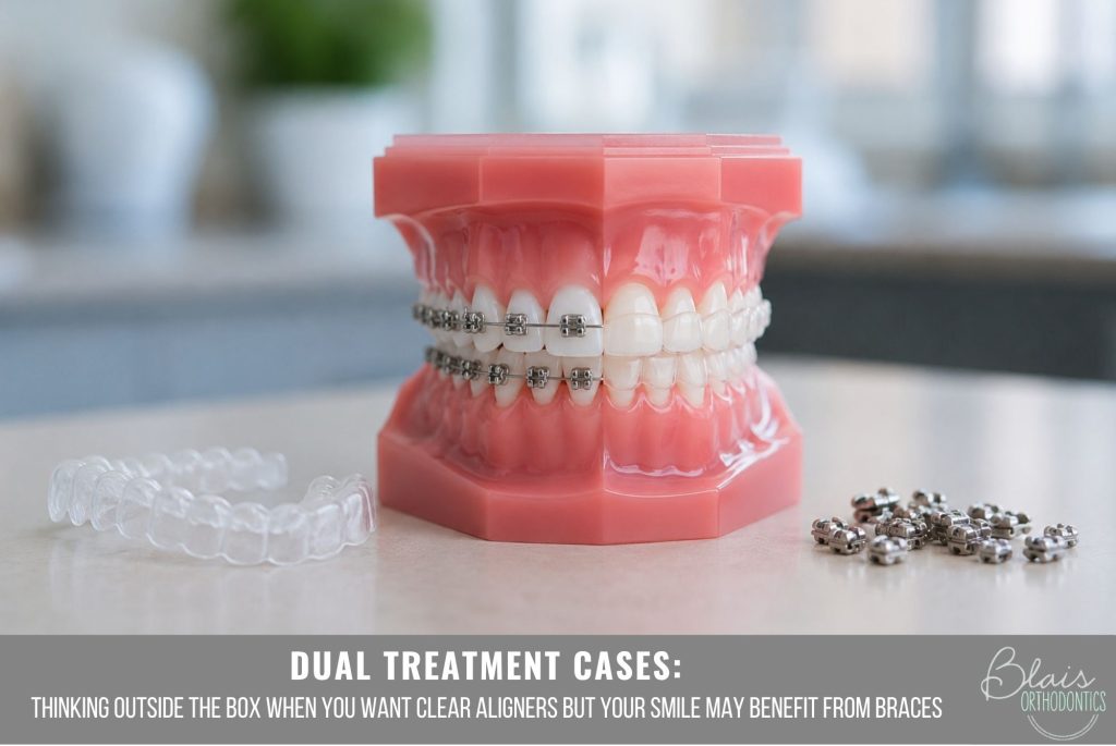 Dual Treatment Cases: Thinking Outside the Box When You Want Clear Aligners but Your Smile May Benefit from Braces